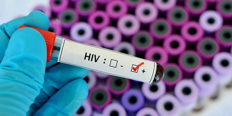 Biguaçu tem Semana de Prevenção às Infecções Sexualmente transmissíveis