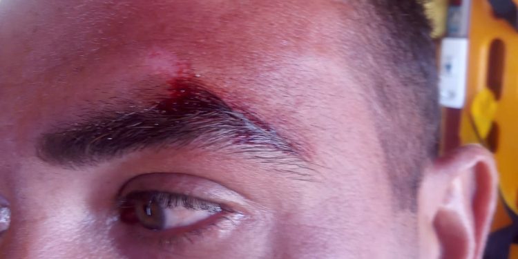 Guarda-vidas é agredido a socos ao tentar salvar banhista na praia em SC