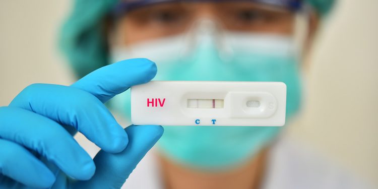 Projeto paga 50 reais para quem fizer teste de HIV em Florianópolis